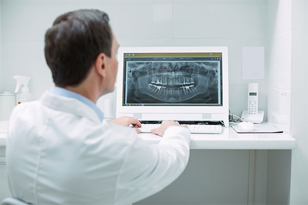 Digital Radiographs