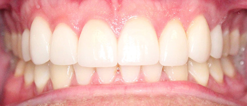 orthodontics after